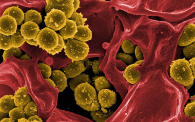 Neuropatie causate anche dalla riduzione della sintesi di acidi grassi.